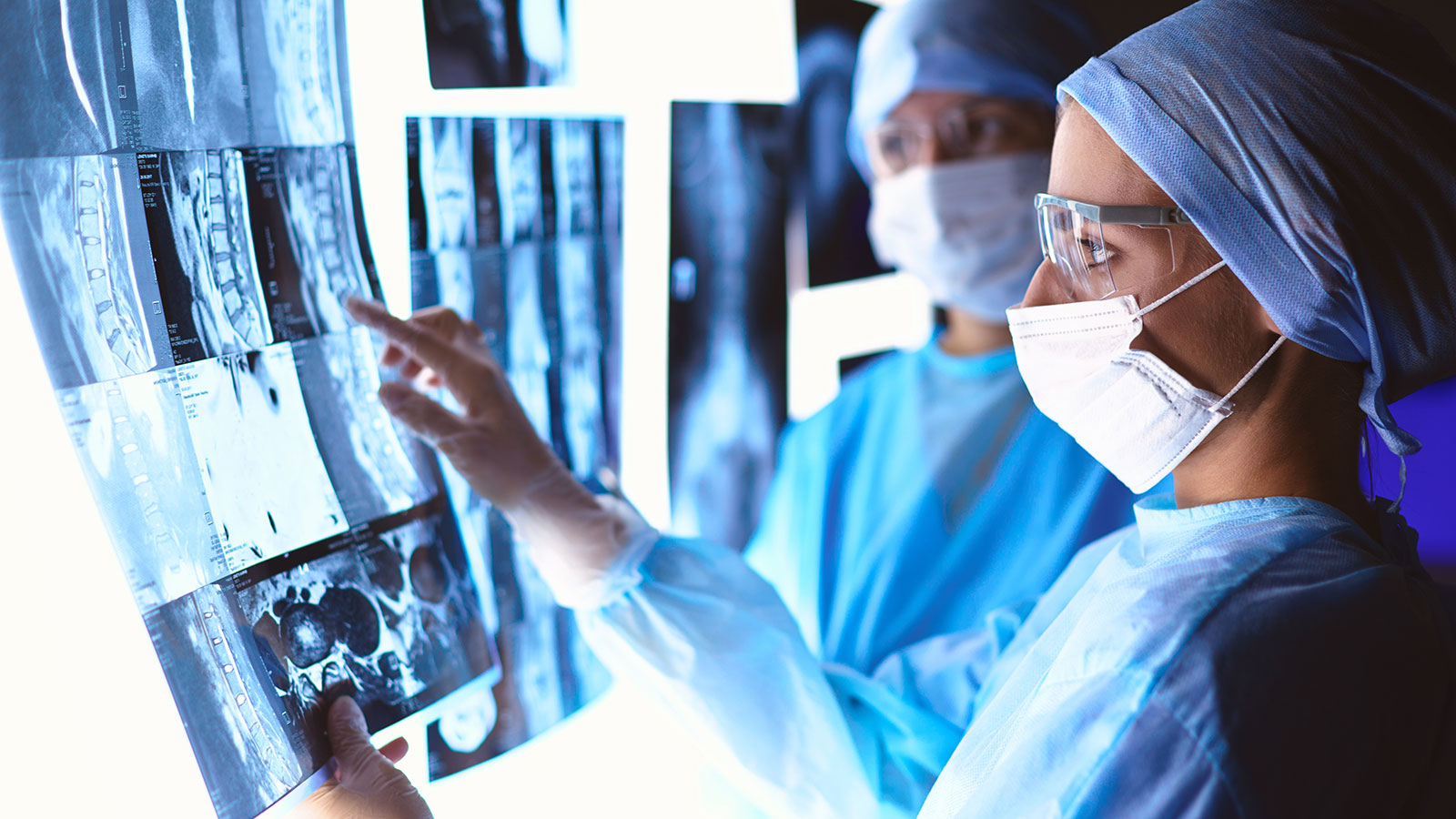 Doctors analyzing an x-ray in a meeting